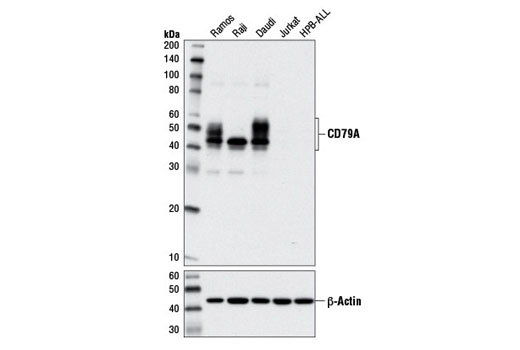  Image 2: B Cell Signaling Antibody Sampler Kit II