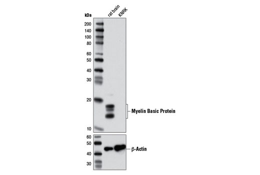 Western Blotting Image 1: Myelin Basic Protein (2H9) Mouse mAb