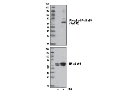 Western Blotting Image 1: Phospho-NF-κB p65 (Ser536) (E1Z1T) Mouse mAb