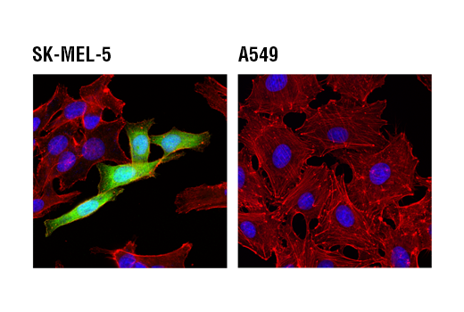 Immunofluorescence Image 1: FABP7 (D8N3N) Rabbit mAb