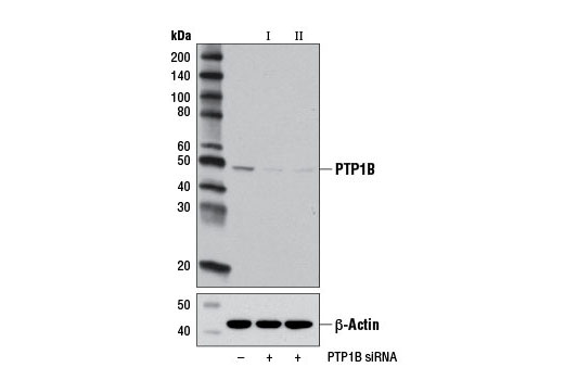  Image 1: SignalSilence® PTP1B siRNA I