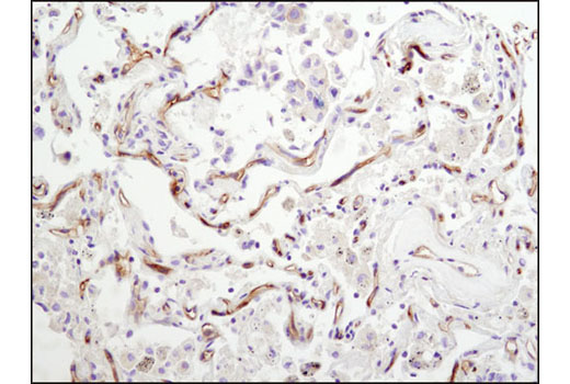 Immunohistochemistry Image 2: CD102/ICAM-2 (D7P2Q) Rabbit mAb