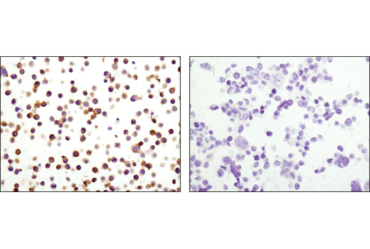 Immunohistochemistry Image 3: CD102/ICAM-2 (D7P2Q) Rabbit mAb