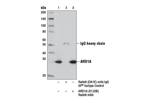 Immunoprecipitation Image 1: ARD1A (E1J2B) Rabbit mAb