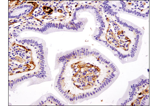  Image 22: ApoE Synaptic Formation and Signaling Pathway Antibody Sampler Kit