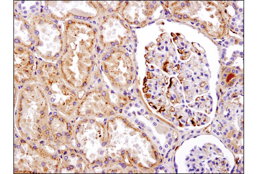  Image 5: LRP1-mediated Endocytosis and Transmission of Tau Antibody Sampler Kit