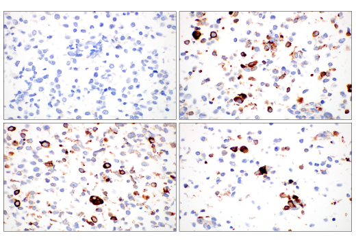  Image 35: LRP1-mediated Endocytosis and Transmission of Tau Antibody Sampler Kit