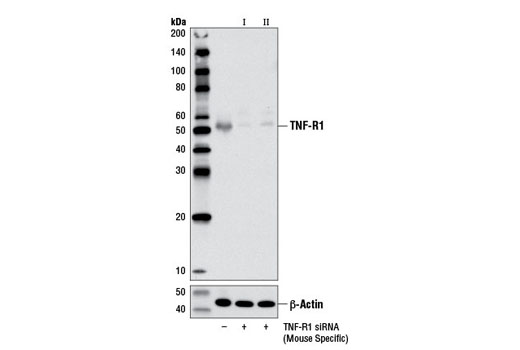  Image 1: SignalSilence® TNF-R1 siRNA I (Mouse Specific)