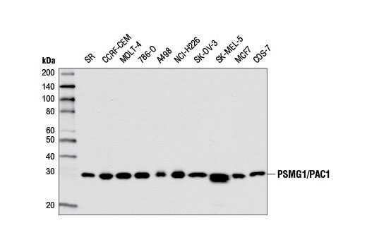 Western Blotting Image 1: PSMG1/PAC1 Antibody