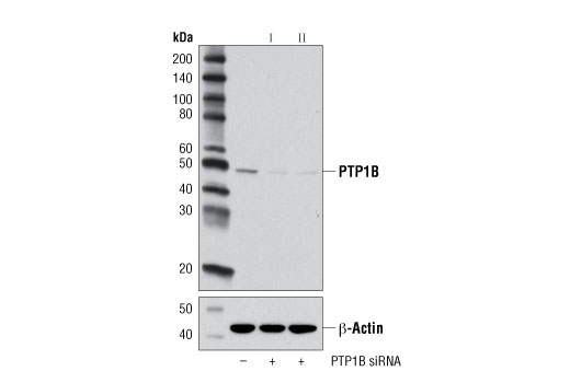  Image 1: SignalSilence® PTP1B siRNA II
