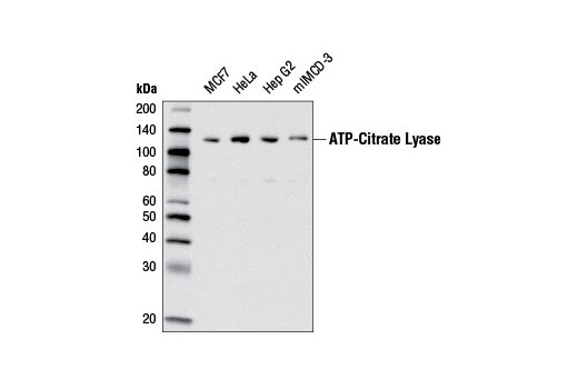 Western Blotting Image 1: ATP-Citrate Lyase (D1X6P) Rabbit mAb