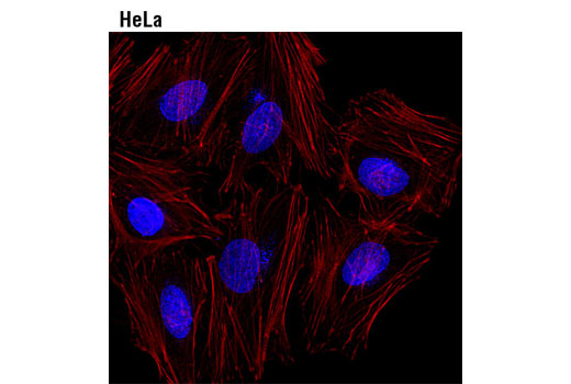 Immunofluorescence Image 1: NUP98 (C39A3) Rabbit mAb (Alexa Fluor® 647 Conjugate)