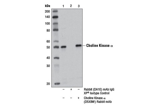 Immunoprecipitation Image 1: Choline Kinase α (D5X9W) Rabbit mAb