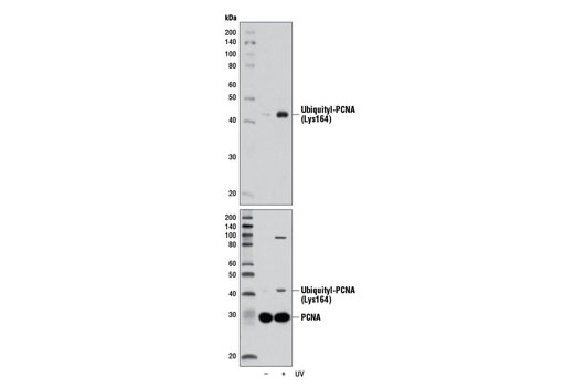 Western Blotting Image 1: Ubiquityl-PCNA (Lys164) (D5C7P) Rabbit mAb