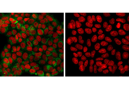 Immunofluorescence Image 1: Sec31A (D1G7I) Rabbit mAb