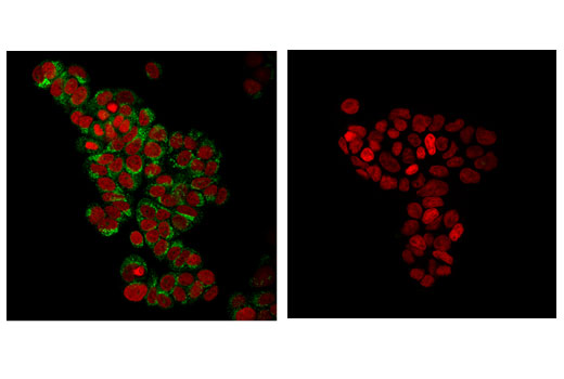 Immunofluorescence Image 1: Sec31A (E1J5M) Rabbit mAb