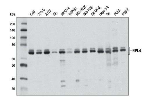 Western Blotting Image 1: NPL4 Antibody