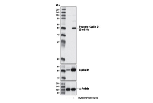 Western Blotting Image 1: Phospho-Cyclin B1 (Ser116) Antibody