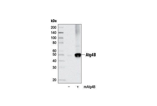 Image 9: Autophagy Vesicle Elongation (LC3 Conjugation) Antibody Sampler Kit