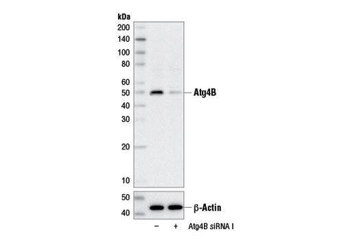  Image 15: Autophagy Vesicle Elongation (LC3 Conjugation) Antibody Sampler Kit