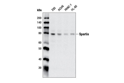 Western Blotting Image 1: Spartin Antibody