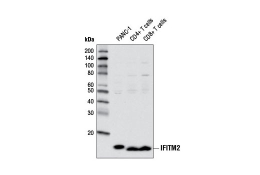 Western Blotting Image 1: IFITM2 Antibody