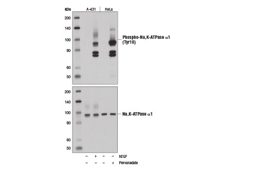 Western Blotting Image 1: Phospho-Na,K-ATPase α1 (Tyr10) (E1Y9C) Rabbit mAb