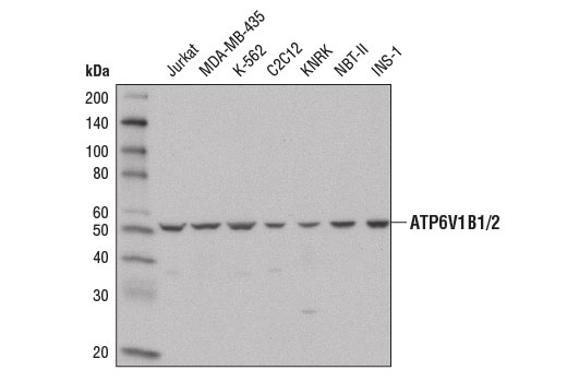Western Blotting Image 1: ATP6V1B1/2 Antibody