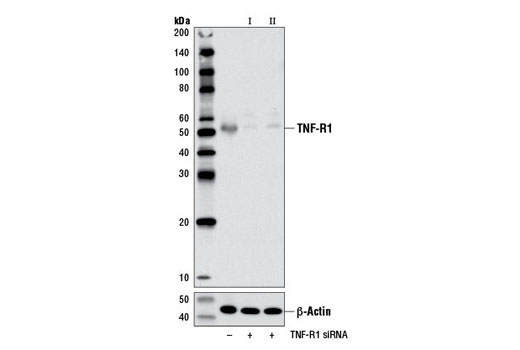  Image 1: SignalSilence® TNF-R1 siRNA II (Mouse Specific)