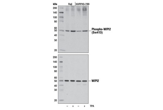 Western Blotting Image 1: Phospho-WIPI2 (Ser413) Antibody