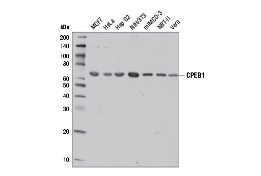 Western Blotting Image 1: CPEB1 Antibody