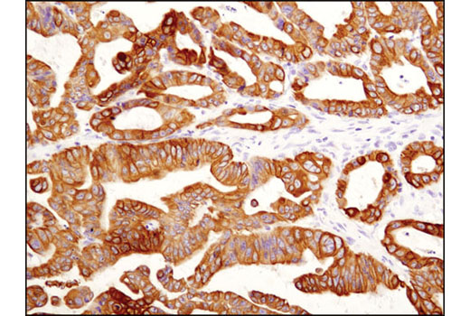 Immunohistochemistry Image 1: Keratin 19 (D7F7W) Rabbit mAb (BSA and Azide Free)