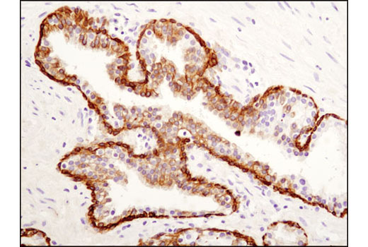 Immunohistochemistry Image 3: Keratin 19 (D7F7W) Rabbit mAb (BSA and Azide Free)