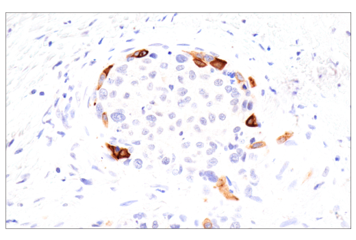 Immunohistochemistry Image 4: Keratin 19 (D7F7W) Rabbit mAb (BSA and Azide Free)