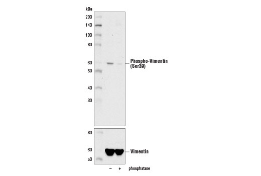 Western Blotting Image 2: Phospho-Vimentin (Ser39) Antibody