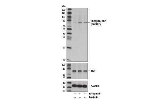  Image 11: Phospho-YAP/TAZ Antibody Sampler Kit
