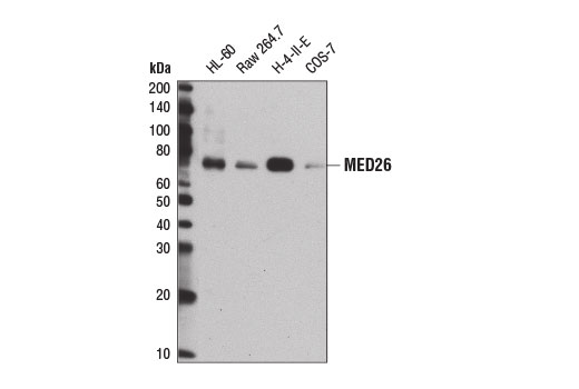 Western Blotting Image 1: MED26 Antibody