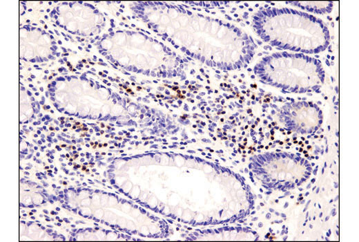 Immunohistochemistry Image 1: PKCθ (E1I7Y) Rabbit mAb