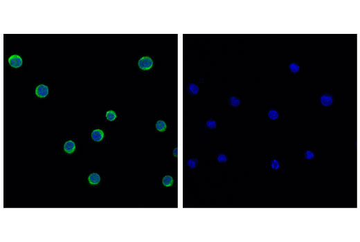Immunofluorescence Image 1: PKCθ (E1I7Y) Rabbit mAb