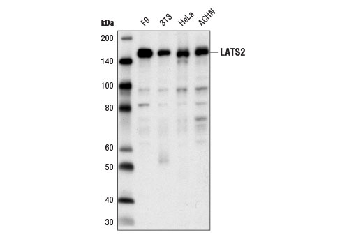 Western Blotting Image 1: LATS2 Antibody
