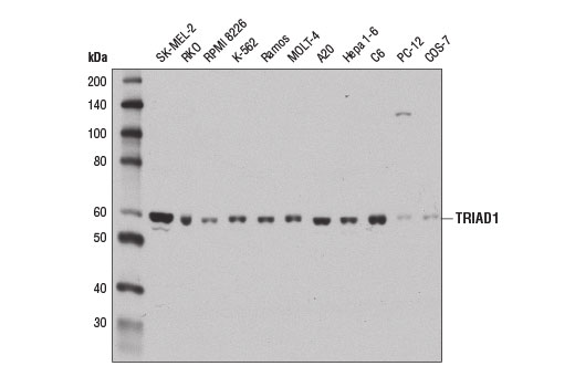 Western Blotting Image 2: TRIAD1 Antibody