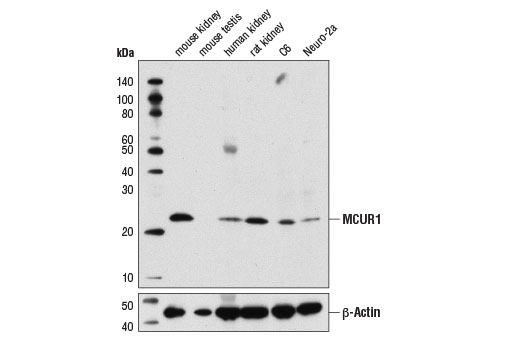 Western Blotting Image 1: MCUR1 Antibody