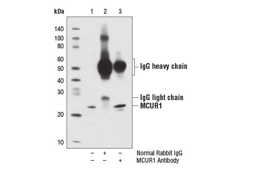 Immunoprecipitation Image 1: MCUR1 Antibody
