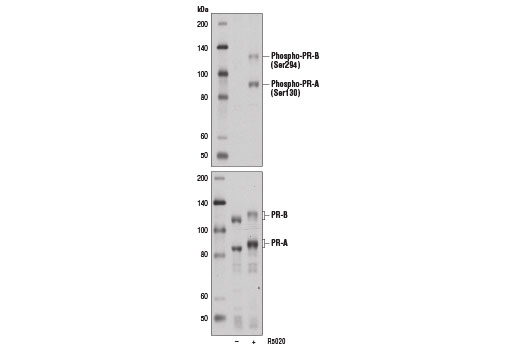 Western Blotting Image 1: Phospho-Progesterone Receptor (Ser294) Antibody