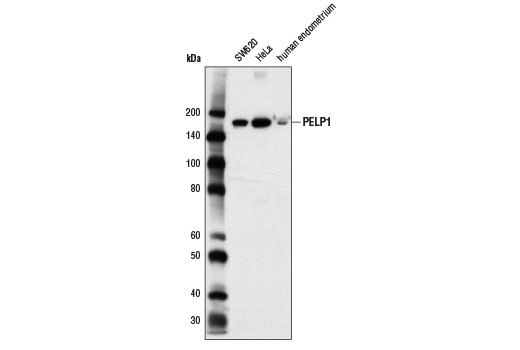 Western Blotting Image 1: PELP1 Antibody