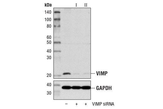  Image 1: SignalSilence® VIMP siRNA II
