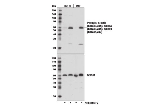  Image 2: Smad 1/5/9 Antibody Sampler Kit