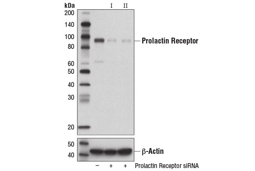  Image 1: SignalSilence® Prolactin Receptor siRNA I