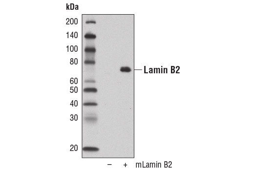 Western Blotting Image 2: Lamin B2 (E1S1Q) Rabbit mAb