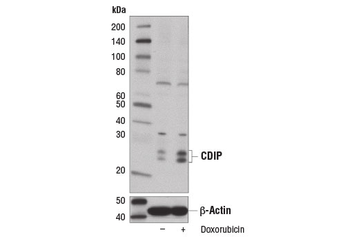 Western Blotting Image 1: CDIP Antibody
